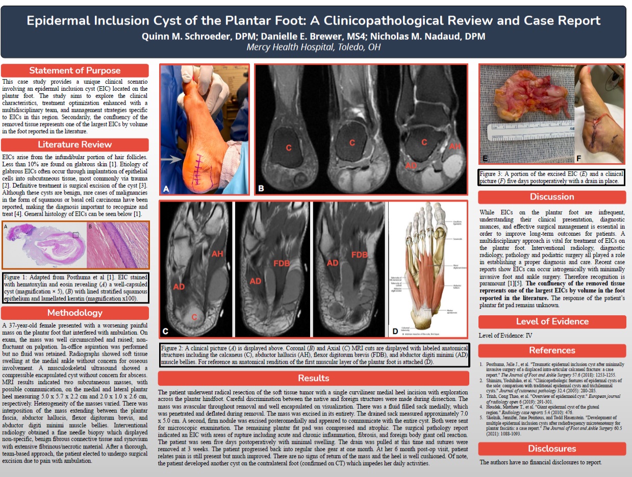Epidermal Inclusion Cyst of the Plantar Foot: A Clinicopathological Review and Case Report